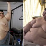 [Covid-19] World’s Fattest Person Beats CoronaVirus